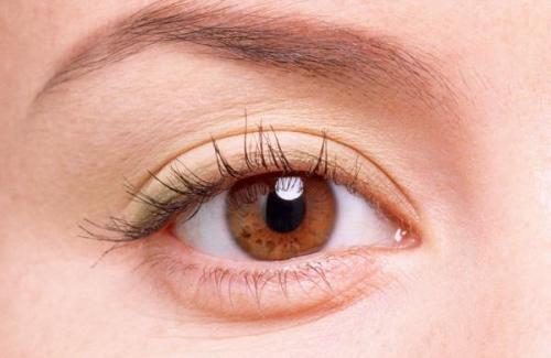 Những triệu chứng của bệnh viêm mi mắt và cách điều trị