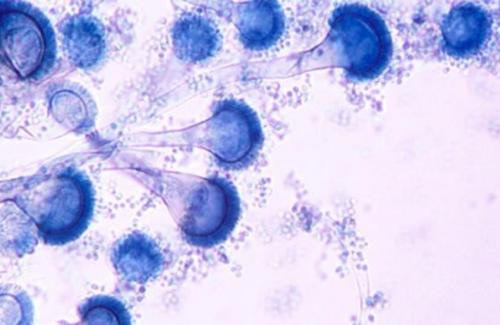 Căn bệnh nấm Mucorales - yếu tố gây bệnh và cách điều trị