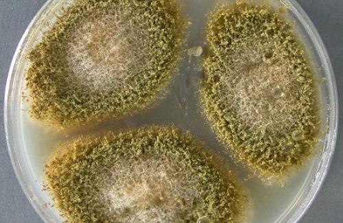 Bệnh nấm sâu Aspergillus là gì? Đối tượng nào dễ mắc nấm Aspergillus?