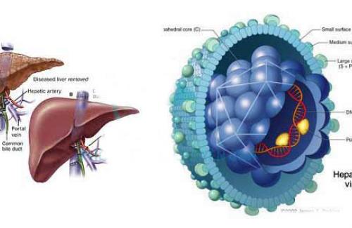 Những triệu chứng nguy hiểm của bệnh viêm gan siêu vi B