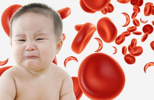 Thiếu máu tán huyết - triệu chứng, nguyên nhân và cách phòng bệnh