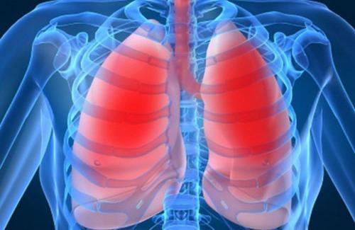 Cách phát hiện các dấu hiệu tiêu chảy và viêm phổi mùa nắng nóng