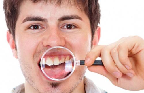 Các vấn đề răng miệng gây biến chứng về bệnh động kinh, mất thính lực