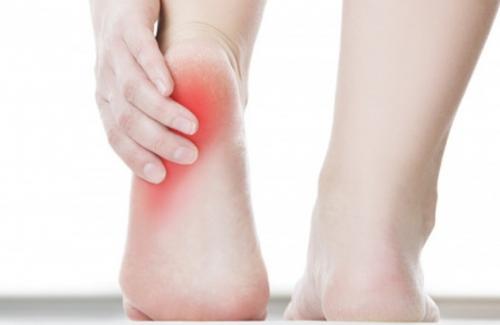 Nguyên nhân đau chân, viêm lớp cân mạc lòng bàn chân do mang giầy dép