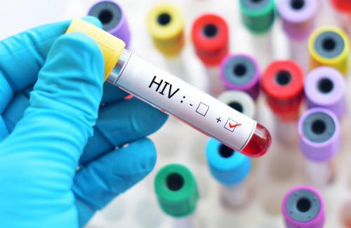 Những giai đoạn phát triển của căn bệnh HIV mà bạn nên biết