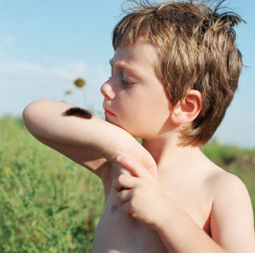 Cách điều trị và phòng tránh ngộ độc sâu róm ở trẻ em