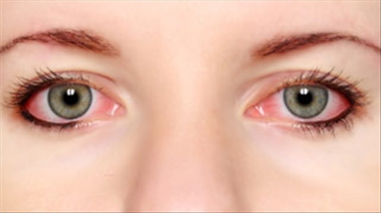 Khi dùng thuốc nhỏ mắt không đúng cách sẽ dẫn đến mù lòa