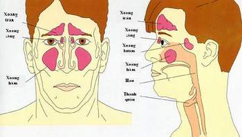 Biểu hiện của bệnh viêm mũi xoang và thuốc trị đặc hiệu