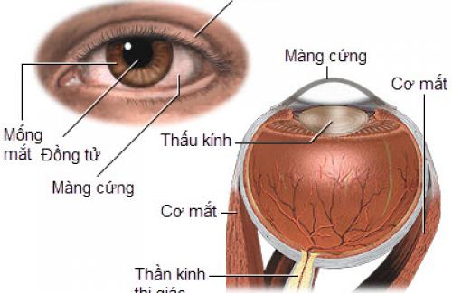 Bệnh viêm mống mắt thể mi có thể gây ra chứng mù lòa