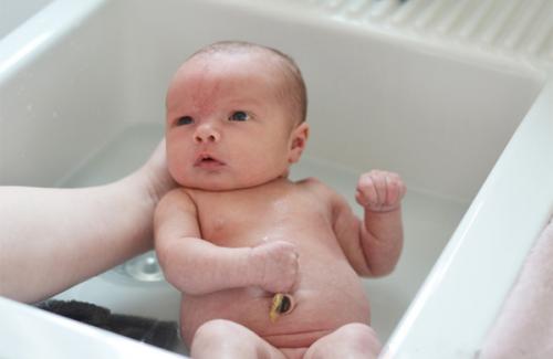 Những cách chăm sóc da và rốn cho trẻ sơ sinh hiệu quả