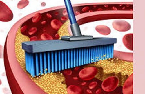 Cách điều trị cholesterol trong máu cao như thế nào để mang tới hiệu quả