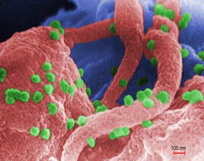 Đông y có thể điều trị khỏi HIV/AIDS được hay không?