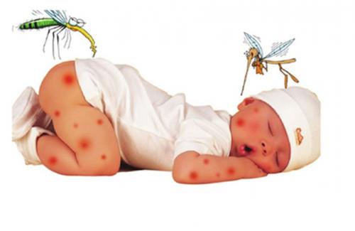 Triệu chứng và phòng ngừa bệnh sốt xuất huyết ở trẻ