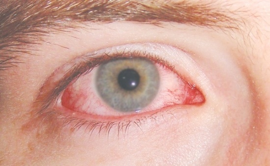 Thuốc điều trị rối loạn cương dương gây ra hiện tượng mờ mắt?