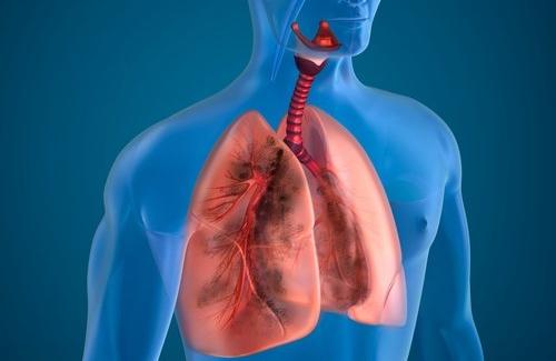Suy hô hấp: Nguyên nhân gây bệnh và một số cách phân loại
