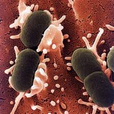Một số loại vi khuẩn thường gây ra ngộ độc thức ăn