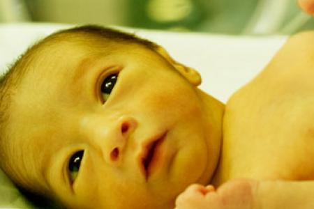Cảnh báo về chứng bệnh vàng da ở trẻ sơ sinh bạn nên biết