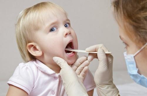 Điều trị nhiệt miệng ở trẻ em phù hợp với từng độ tuổi