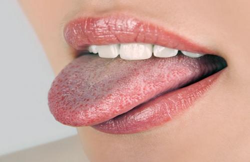 Nhiệt miệng là gì - biểu hiện và những nguyên nhân gây bệnh