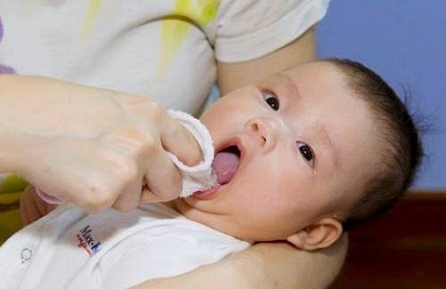 Nhiệt miệng ở trẻ sơ sinh - nguyên nhân và cách điều trị