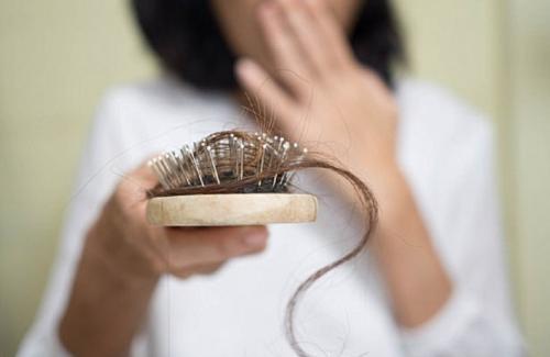 7 nguyên nhân rụng tóc phổ biến nhất hiện nay là gì?