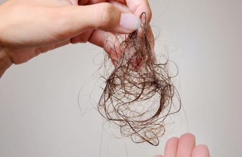 Rụng tóc là dấu hiệu của bệnh gì - phát hiện bệnh thế nào?