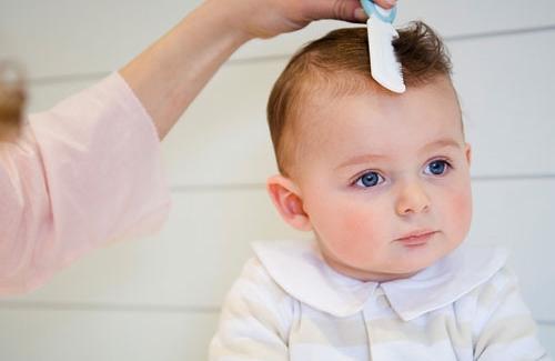 Rụng tóc ở trẻ 3 tháng tuổi - nguyên nhân và cách chữa trị