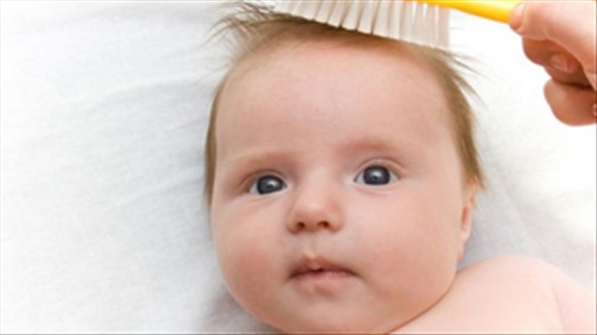 Tư thế nằm: Nguyên nhân chính gây rụng tóc ở trẻ sơ sinh