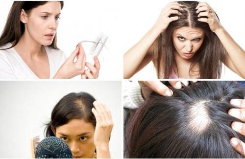 Nguyên nhân gây rụng tóc ở phụ nữ do thói quen và bệnh lý nào?