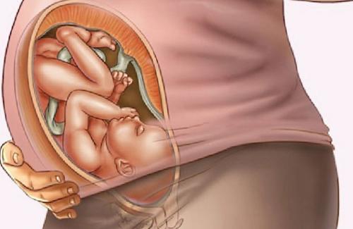 Những vị trí nằm “oái oăm” của thai nhi khi trong bụng mẹ