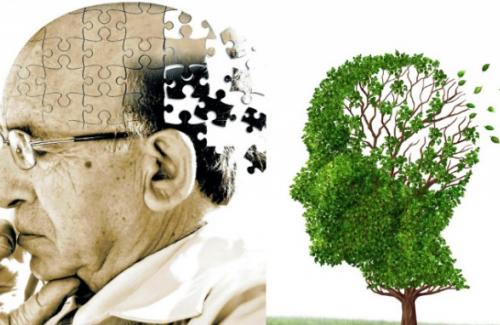 “Đại dịch Alzheimer”, Nguyên nhân và hướng phòng tránh
