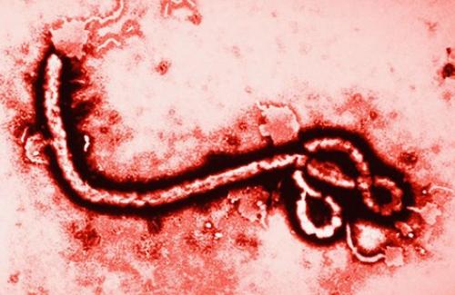 Nhiễm virus Ebola cảnh báo bạn có thể nguy hiểm tính mạng