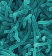 Vi khuẩn Listeria Monocytogenes gây đau mỏi cơ và tiêu chảy
