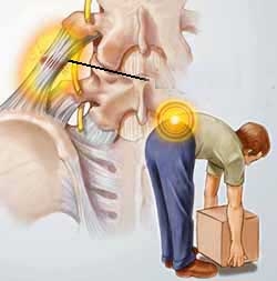 Để khắc phục chứng đau thắt lưng phải xác định được căn nguyên của bệnh