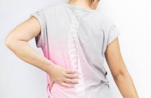 Cách chữa gai cột sống lưng phổ biến và hiệu quả nhất