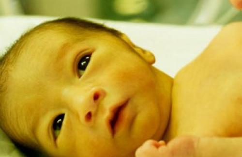 Vàng da ở trẻ sơ sinh - Các phương pháp điều trị bệnh dứt điểm