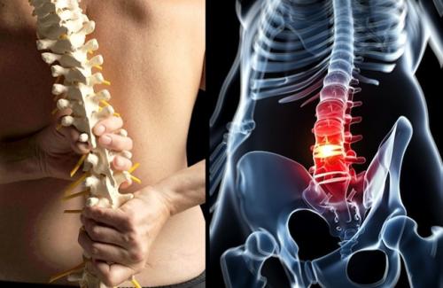 Một số cách xử trí khi bị chấn thương cột sống lưng