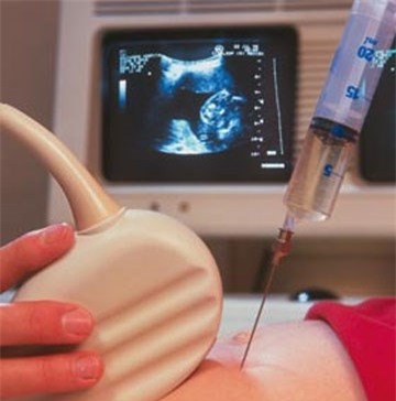 Phòng ngừa và phát hiện sớm thai bất thường trước khi quá muộn
