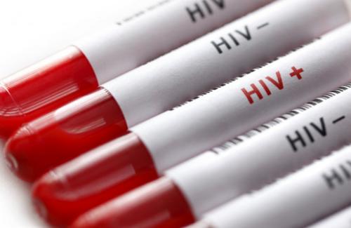 Những nguyên nhân khiến bạn bị nhiễm HIV/AIDS nguy hiểm