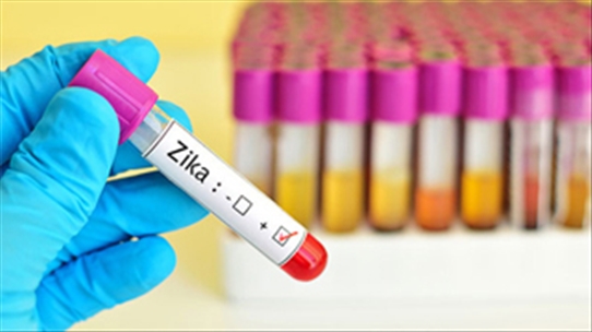 Phòng tránh và điều trị khi biết nhiễm vi-rút zika