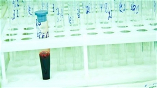 ok:Trung Quốc phát hiện loại gel ngăn chặn HIV/AIDS lây qua đường tình dục
