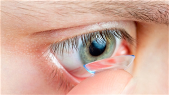 Điều trị cận thị không cần phẫu thuật đem lại hiệu quả cao