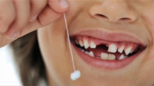 Hậu quả khi mất răng sữa sớm ít người lường trước được