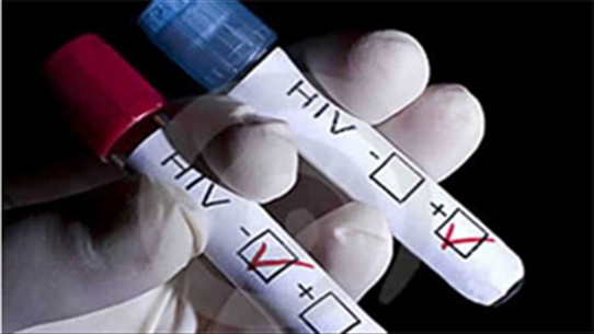 Thời gian xét nghiệm HIV mất bao lâu? Kết quả có chính xác không?