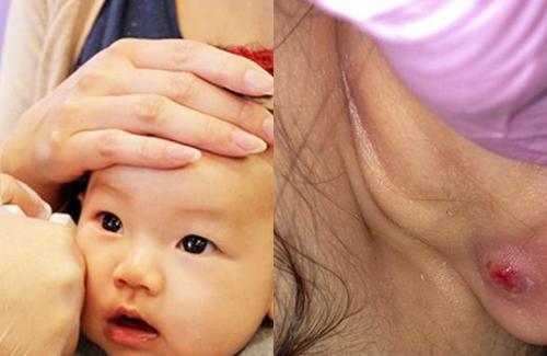 Làm mẹ: Ham bấm lỗ tai cho bé sơ sinh, mẹ nhận hậu quả khó lường