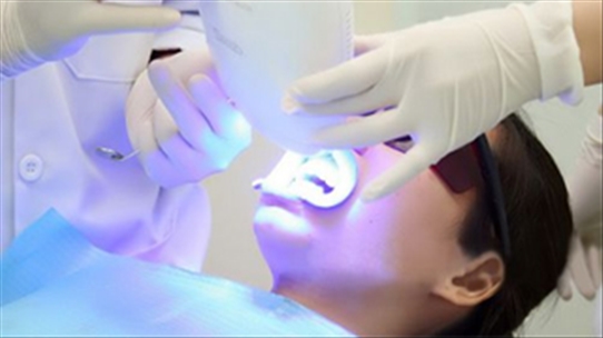 Những điều nên biết khi tẩy trắng răng để an toàn sức khỏe