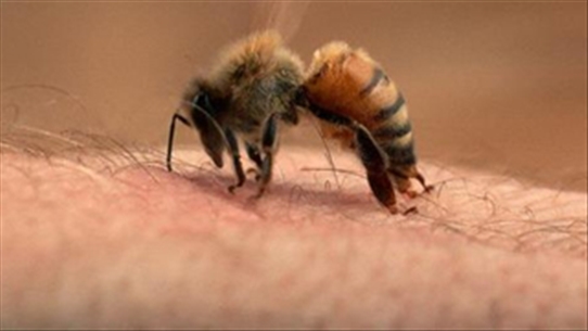 Làm thế nào để đối phó nhanh với nọc độc của ong?