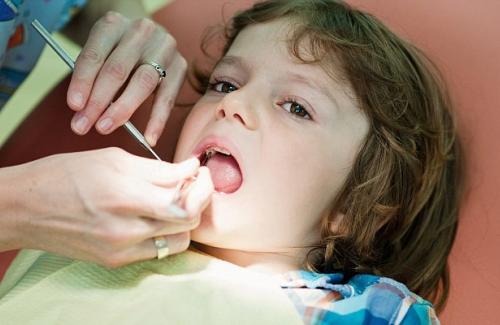 Trẻ bú bình sau 2 tuổi khiến răng bị xấu, bạn có biết không?