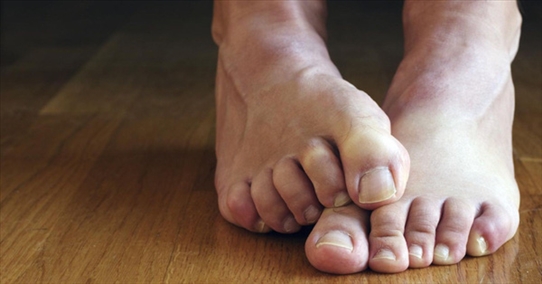 Hôi chân thường xuất hiện trong tiết trời nồm ẩm, làm thế nào để xử lý triệt để?