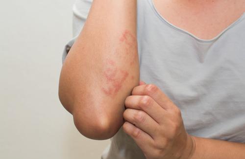 4 dấu hiệu chứng tỏ bạn đang mắc bệnh nguy hiểm trên da